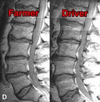 Bauer (links) - Fahrer (rechts)